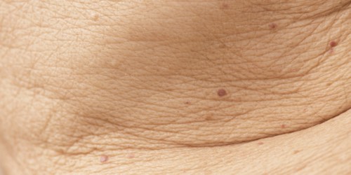 Close up of skin Close up of skin